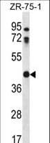 CTSO Antibody (aa69-98)