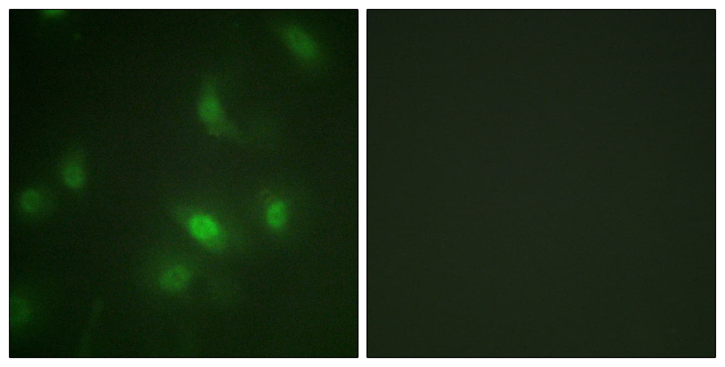 STAT5 A+B Antibody (phospho-Ser725/Ser730)