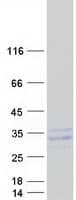 Human PAEP / Glycodelin / GdF Protein (Recombinant Myc-DDK (Flag))