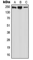 WNK2 Antibody (Internal)