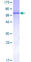 Human ADH4 Protein (Recombinant GST)