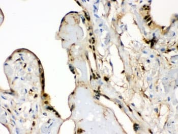 S100A6 / Calcyclin Antibody