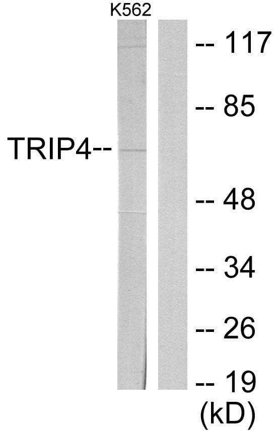 TRIP4 / ASC-1 Antibody