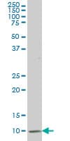 ATP6V1G2 Antibody (clone 2E11)