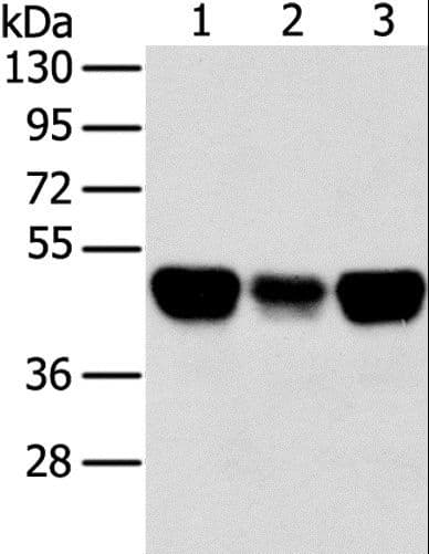 TRIM21 / RO52 Antibody