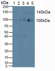 PRKD1 / PKC Mu Antibody (aa651-876)