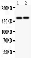 Polyclonal Rabbit anti-Human CD45 / LCA Antibody (aa1113-1304, IHC, WB)