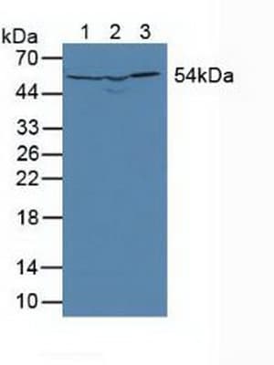 DLD / Diaphorase / E3 Antibody (aa45-271)
