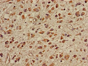 Polyclonal Rabbit anti-Human TGDS Antibody (IHC)