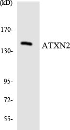 ATXN2 / SCA2 / Ataxin-2 Antibody (aa725-774)