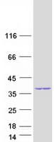 Human GEMIN8 Protein (Recombinant Myc-DDK (Flag))