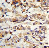 KRT14 / CK14 / Cytokeratin 14 Antibody (aa276-303)