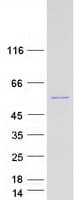 Human SETD6 Protein (Recombinant Myc-DDK (Flag))