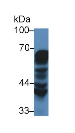HSPD1 / HSP60 Antibody (aa28-573, PE)
