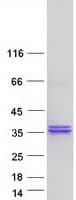 Human RPIA / RPI Protein (Recombinant Myc-DDK (Flag))