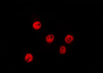CSRNP3 Antibody
