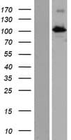 INTU Protein (Over-Expression Lysate Myc-DDK (Flag))