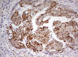 HADH Antibody (aa57-314, clone OTI3D12)
