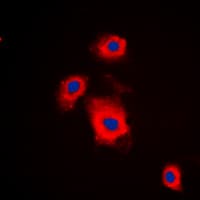 Polyclonal Rabbit anti-Human RPS6KB1 / P70S6K / S6K Antibody (phospho-Ser447, IHC, IF, WB)