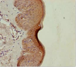 Polyclonal Rabbit anti-Human LRSAM1 Antibody (IHC, WB)