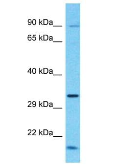 Polyclonal Rabbit anti-Human TCTEX1D1 Antibody (aa16-65, WB)