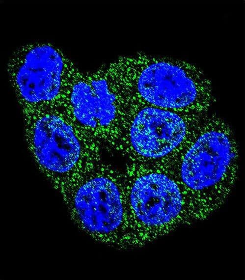 GSTP1 / GST Pi Antibody (aa165-192)