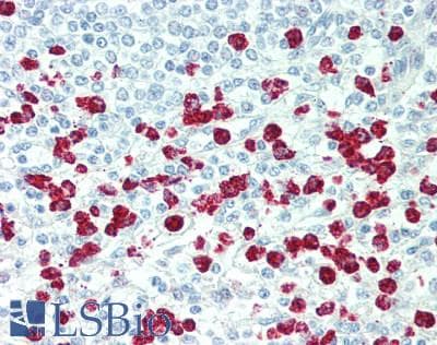 VAC14 / TRX Antibody (aa125-159)