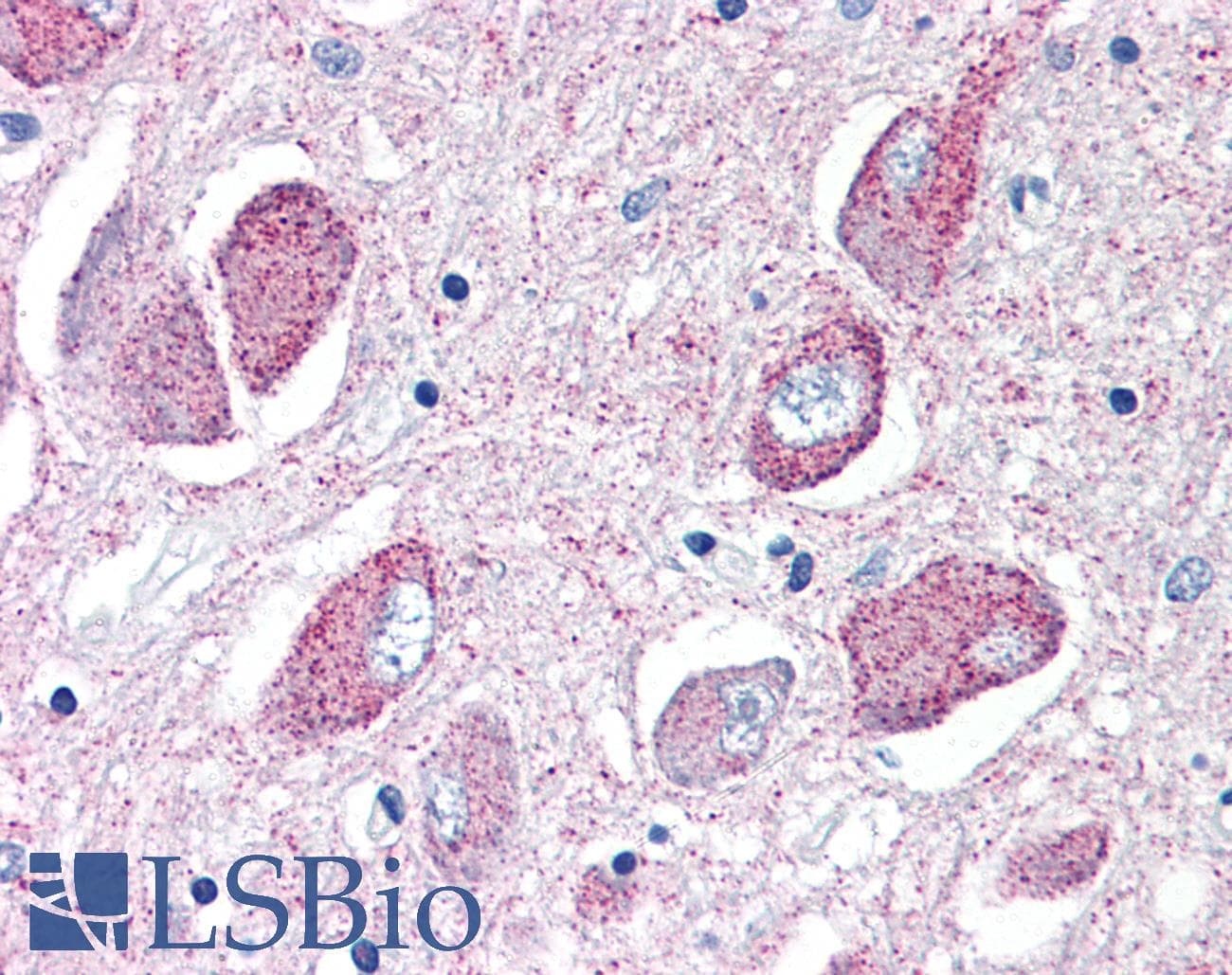 IHC-plus™ WNT8B / Wnt 8b Antibody (Internal)