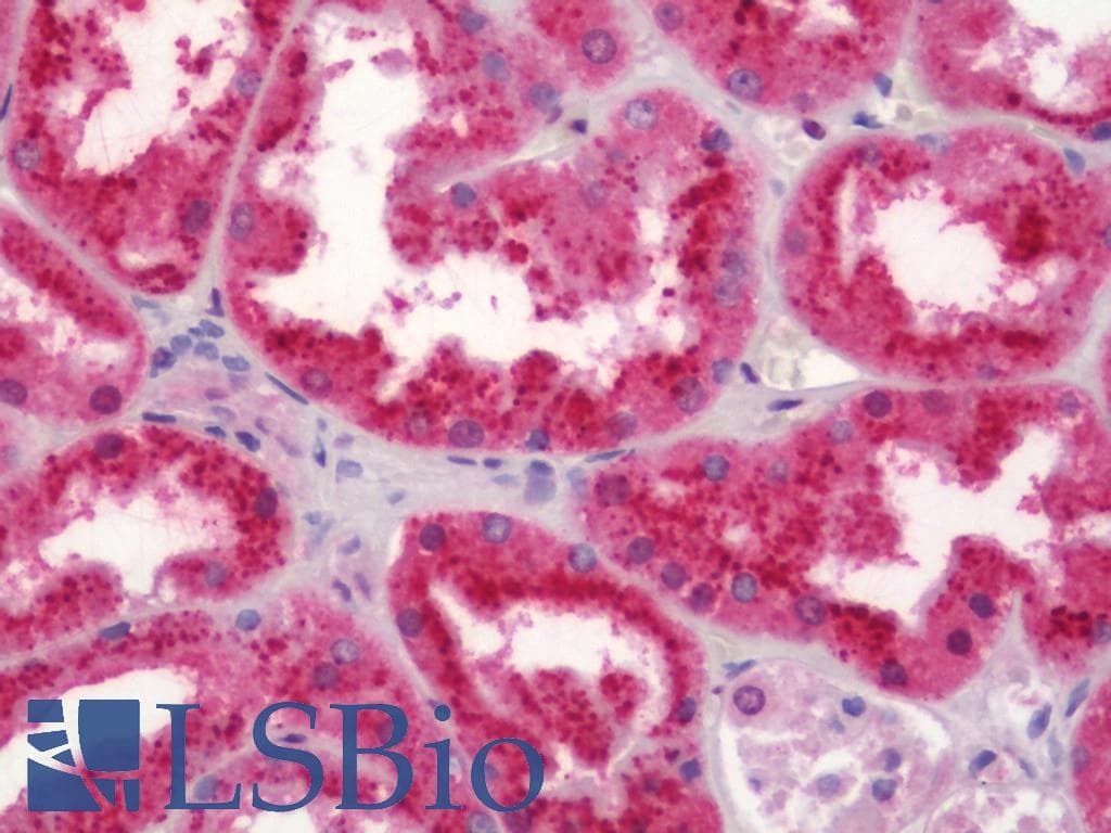 IHC-plus™ Polyclonal Rabbit anti-Human RPS19 / Ribosomal Protein S19 Antibody (aa81-130, IHC, WB)