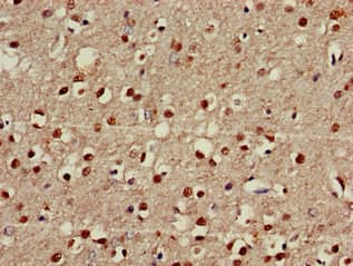 FOXRED2 Antibody