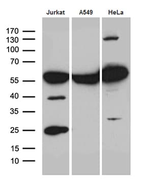 Monoclonal Mouse anti-Human PTBP3 / ROD1 Antibody (clone OTI5G7, aa300-552, IHC, WB)