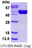 Influenza A Virus H3 Protein (Recombinant His)