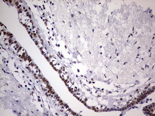C14orf166 Antibody (clone OTI1B2)