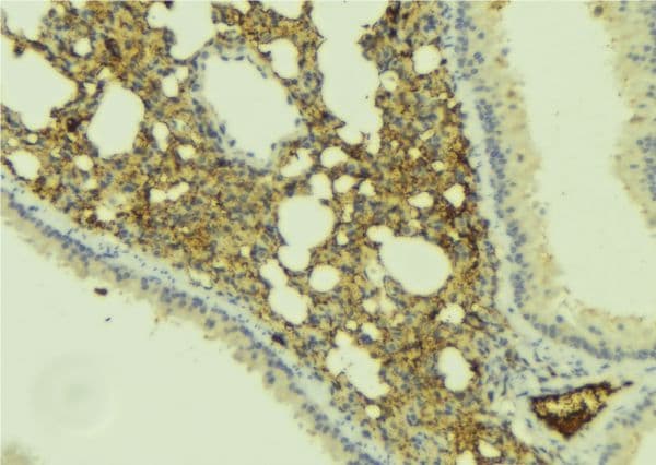 MMP25 / Leukolysin Antibody