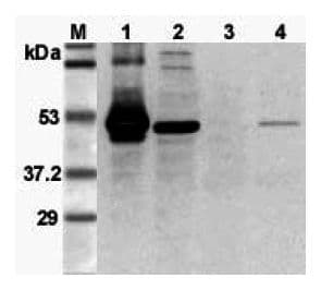 FOXP3 Antibody