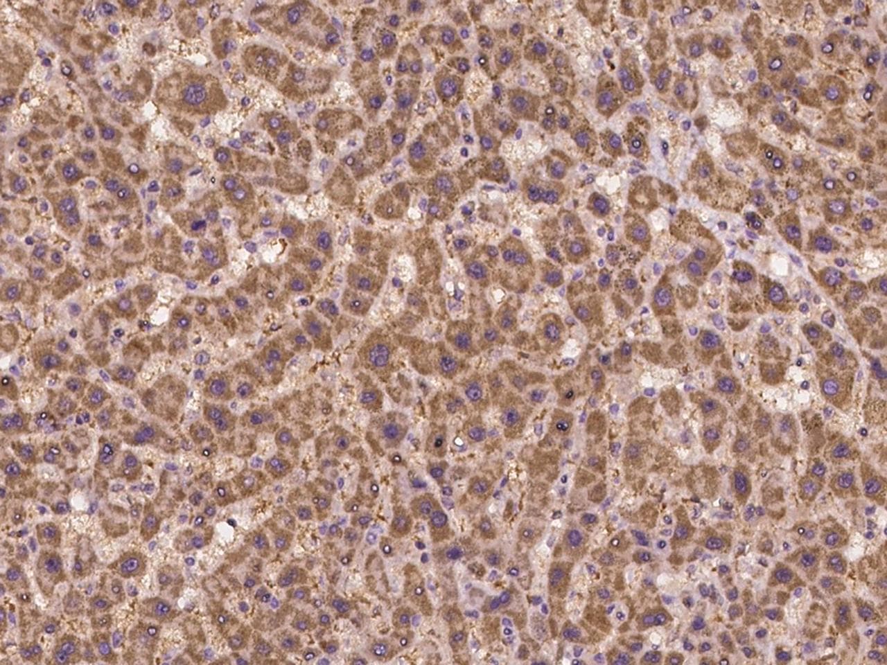 SLC2A7 / GLUT7 Antibody