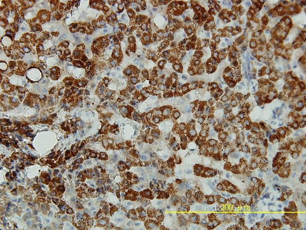 Monoclonal Mouse anti-Human P5CDH / ALDH4A1 Antibody (clone 1A12-A5, IHC, WB)