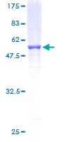 Human NDUFS3 Protein (Recombinant GST)