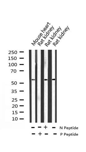 ATF2 Antibody (phospho-Ser112,pSer94)