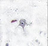PIK3R2 / p85 Beta Antibody (aa1-30)