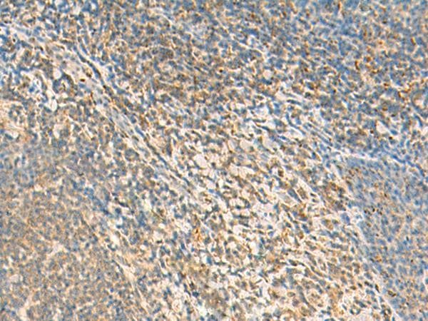 TXNDC12 Antibody