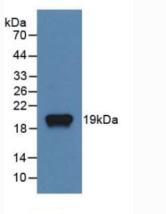 TNFSF11 / RANKL / TRANCE Antibody
