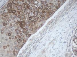 MAGEB1 Antibody (clone OTI4E12)