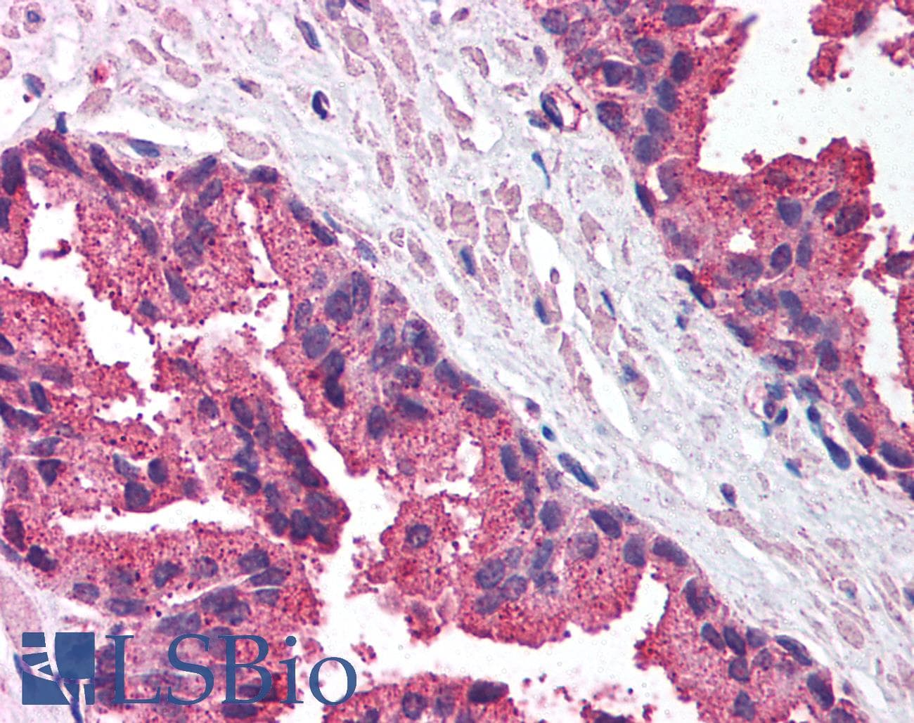 MICA Antibody