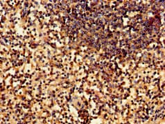 WNK1 Antibody