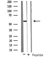 Polyclonal Rabbit anti-Human KLF4 Antibody (IHC, WB)