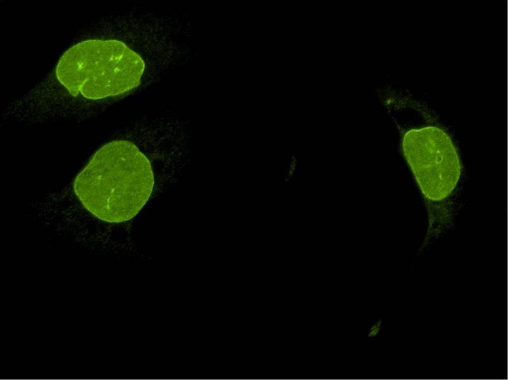 Polyclonal Rabbit anti-Human UNC84B / SUN2 Antibody (IF, WB)