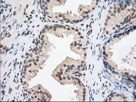 ERIC-1 / TACC3 Antibody (clone OTI8F6, Carrier-free)