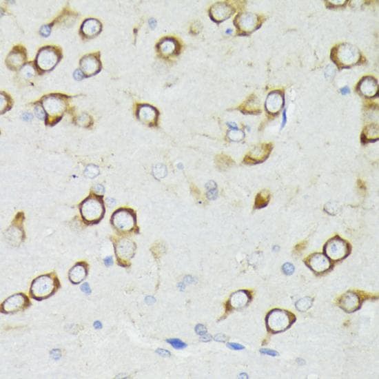 PDPK1 / PDK1 Antibody