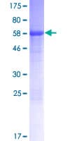 Human TEX13B Protein (Recombinant GST)